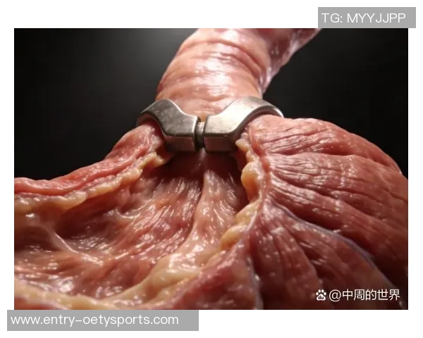 通过坚持体育锻炼成功治愈霉菌性食管炎的真实案例分享